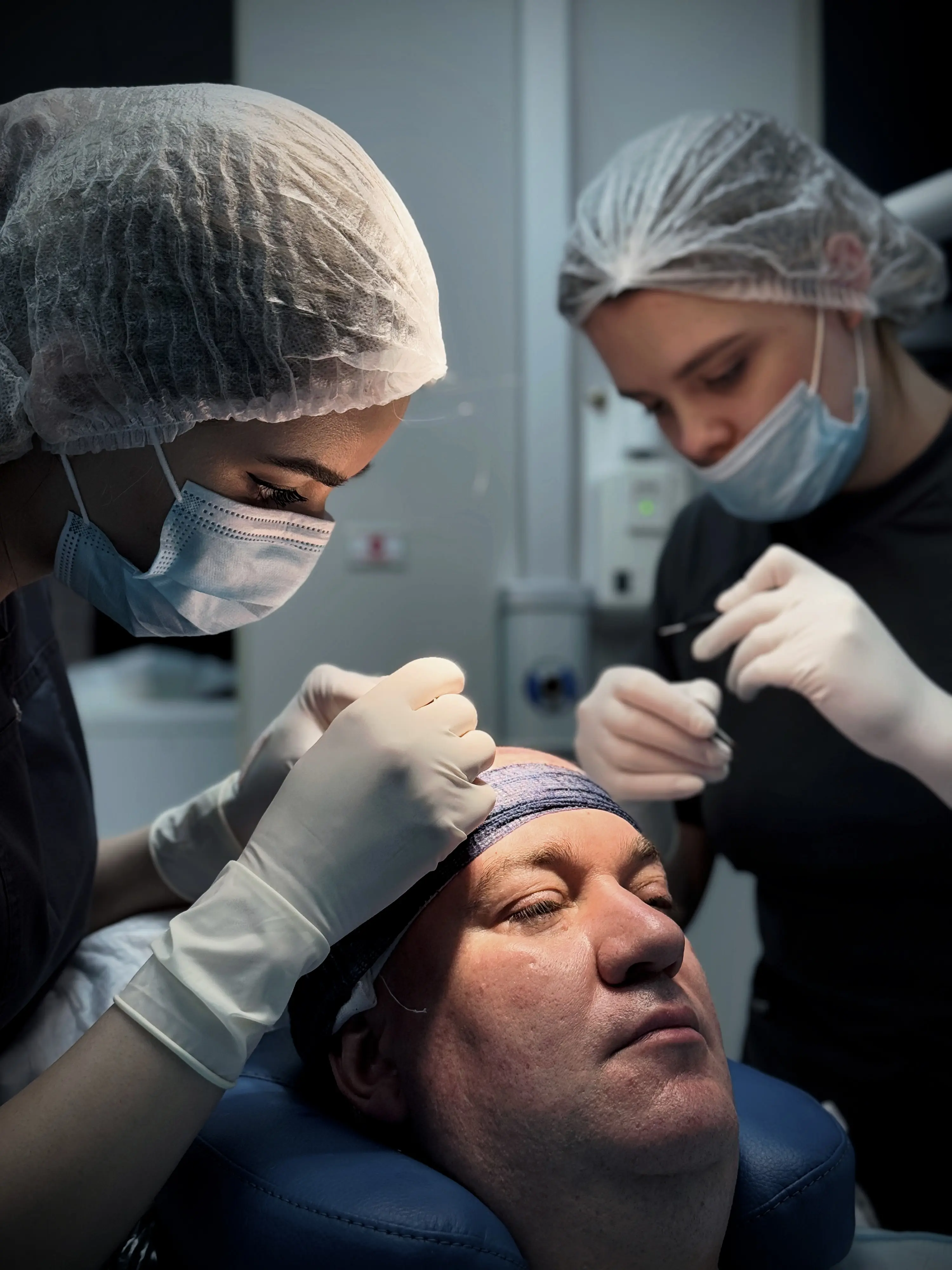 Метод FUE - этап 2