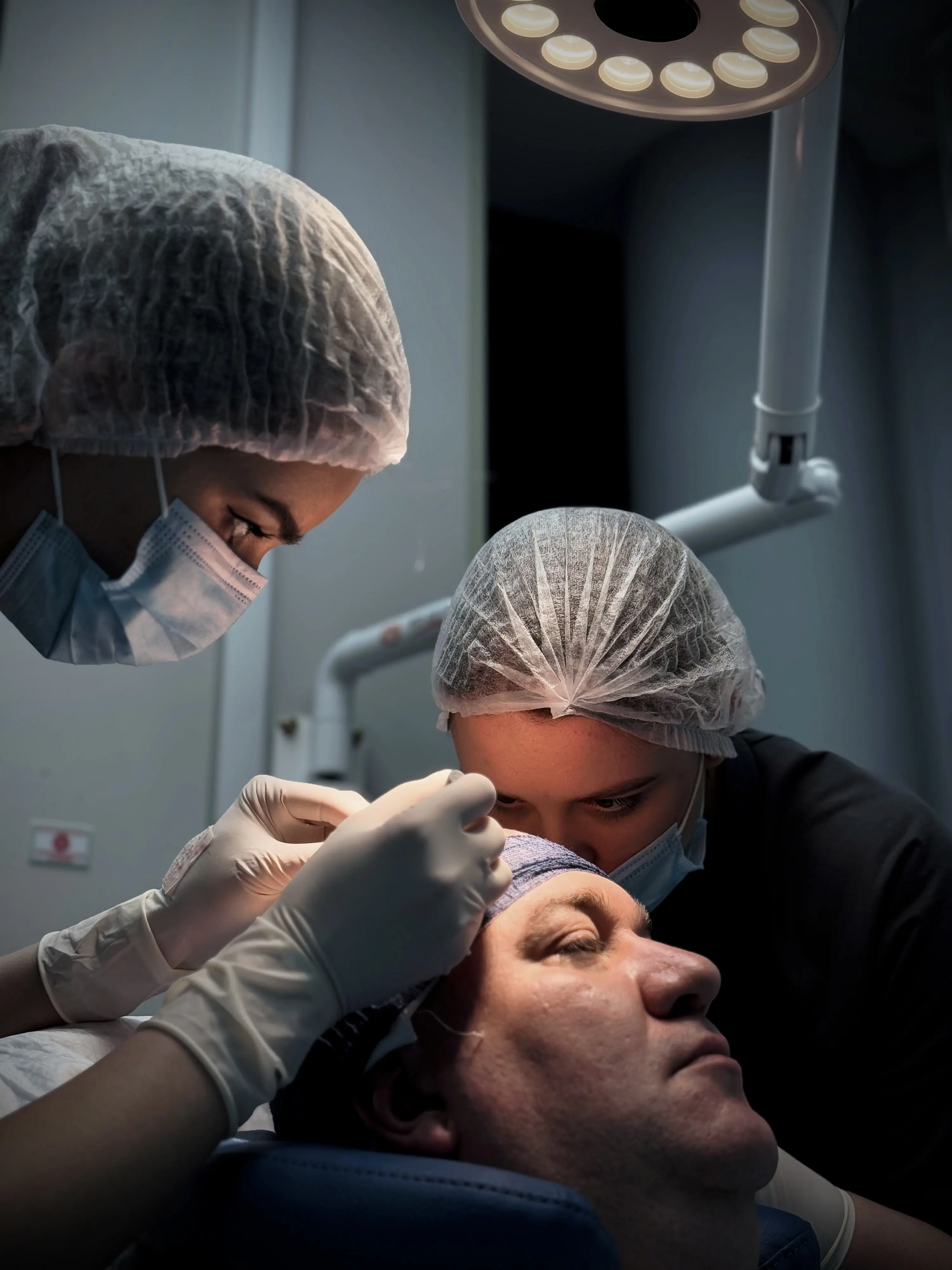 Метод FUE - этап 4