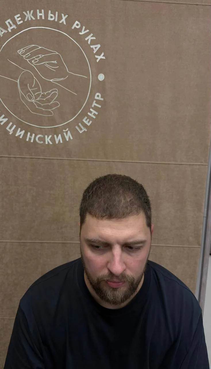 До пересадки волос