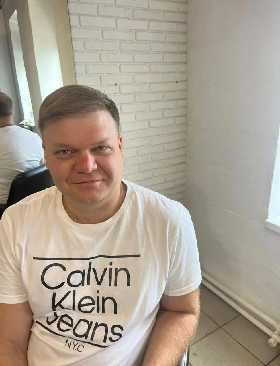 До пересадки волос